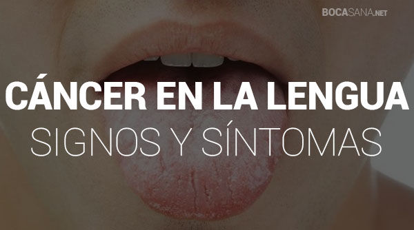 signos y sintomas del cancer en la lengua
