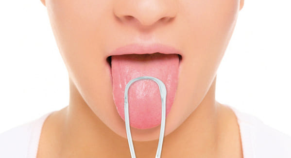 como curar la lengua agrietada