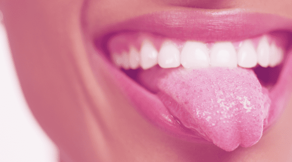 manchas en la lengua