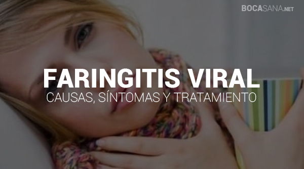 Faringitis Viral