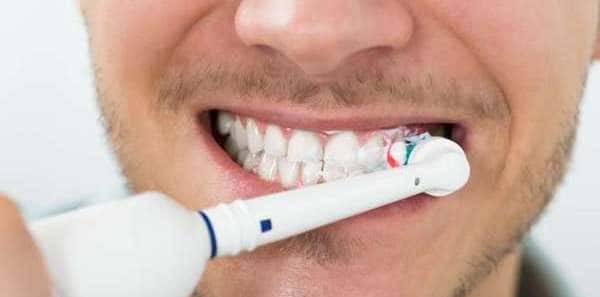 tratamiento sensibilidad dental