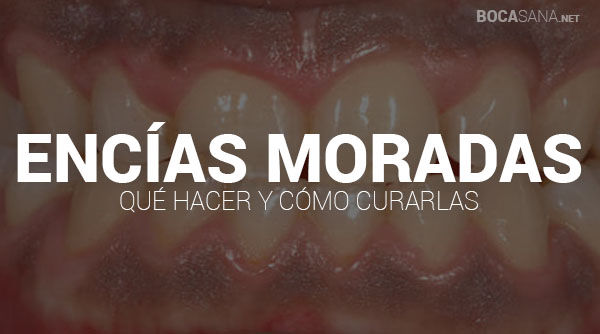ENCIAS MORADAS