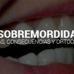 SOBREMORDIDA